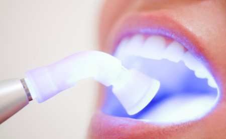 Tratamientos de Blanqueamiento Dental en Jaén de Espacio Dental Jaén