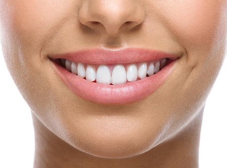 Blanqueamiento dental en Jaén en Espacio Dental Jaén