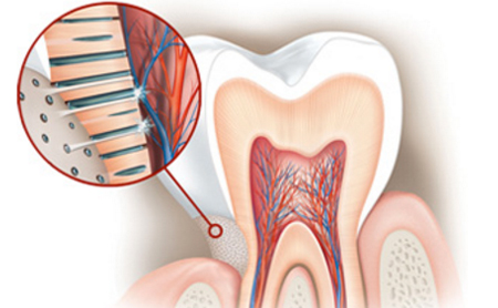 Dientes sensibles Nervios - Espacio Dental Jaén Dientes sensibles Nervios - Espacio Dental Jaén