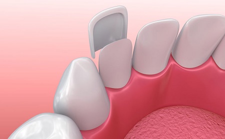 Home - Endodoncia en Espacio Dental Jaén