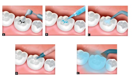 Dentista en Jaén - Clínica Dental en Jaén - Espacio Dental Jaén Dentista en Jaén - Clínica Dental en Jaén - Espacio Dental Jaén