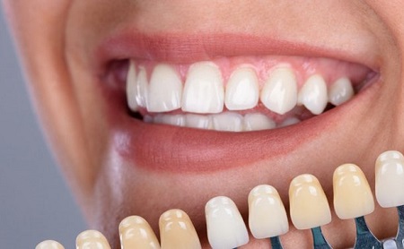 Endodoncia en Jaén en Espacio Dental Jaén