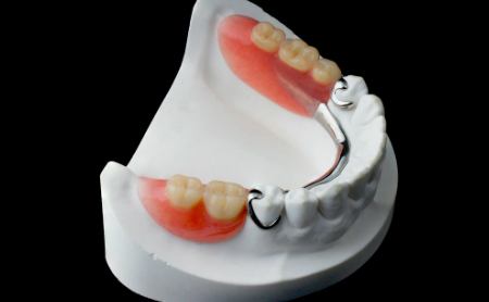 Prótesis Dentales Jaén Espacio Dental Jaén